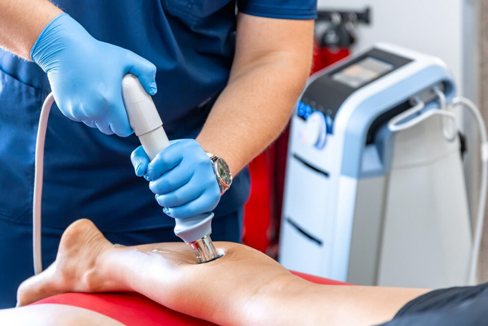 Radial shockwave therapy (RSWT) falls under extracorporeal shockwave therapy (ESWT)