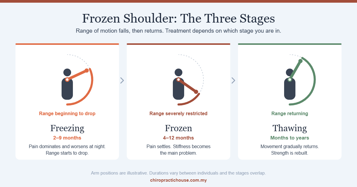 Diagram of the three stages of frozen shoulder — freezing, frozen and thawing — showing shoulder range of motion falling and then returning.