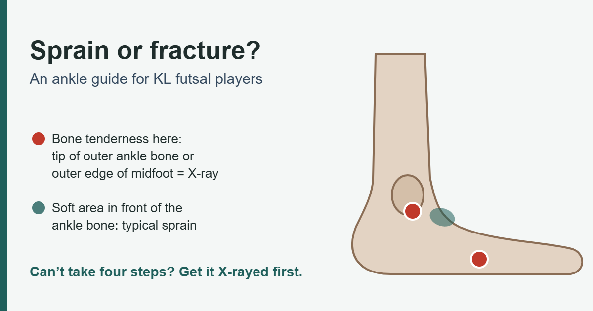 Side-view diagram of an ankle marking the Ottawa ankle rule points: tenderness at the tip of the outer ankle bone or the outer edge of the midfoot suggests an X-ray is needed, while tenderness in the soft area in front of the ankle bone is typical of a sprain.