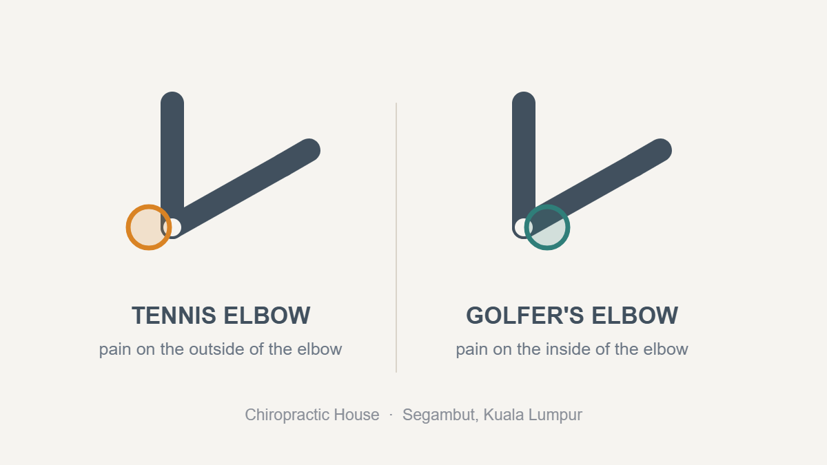 Two simple diagrams of a bent arm side by side: the left marks pain on the outside of the elbow labelled tennis elbow, the right marks pain on the inside of the elbow labelled golfer’s elbow